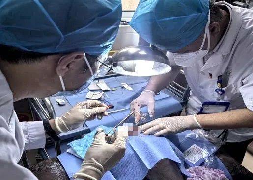 圣保利vs多特蒙德_太突然！上海98岁阿婆拿起剪刀圣保利vs多特蒙德，一把剪掉头上的“角”！网友：对自己够狠